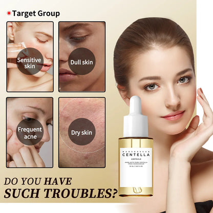 Zora Madagascar Centella Comfort Serum in a glass bottle with a dropper for face skincare and soothing treatment.