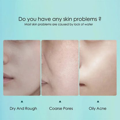 Zora Hyaluronic Acid Hydrating Facial Sheet Mask, skincare face mask pack with 10 sheets for deep moisture and skin rejuvenation.