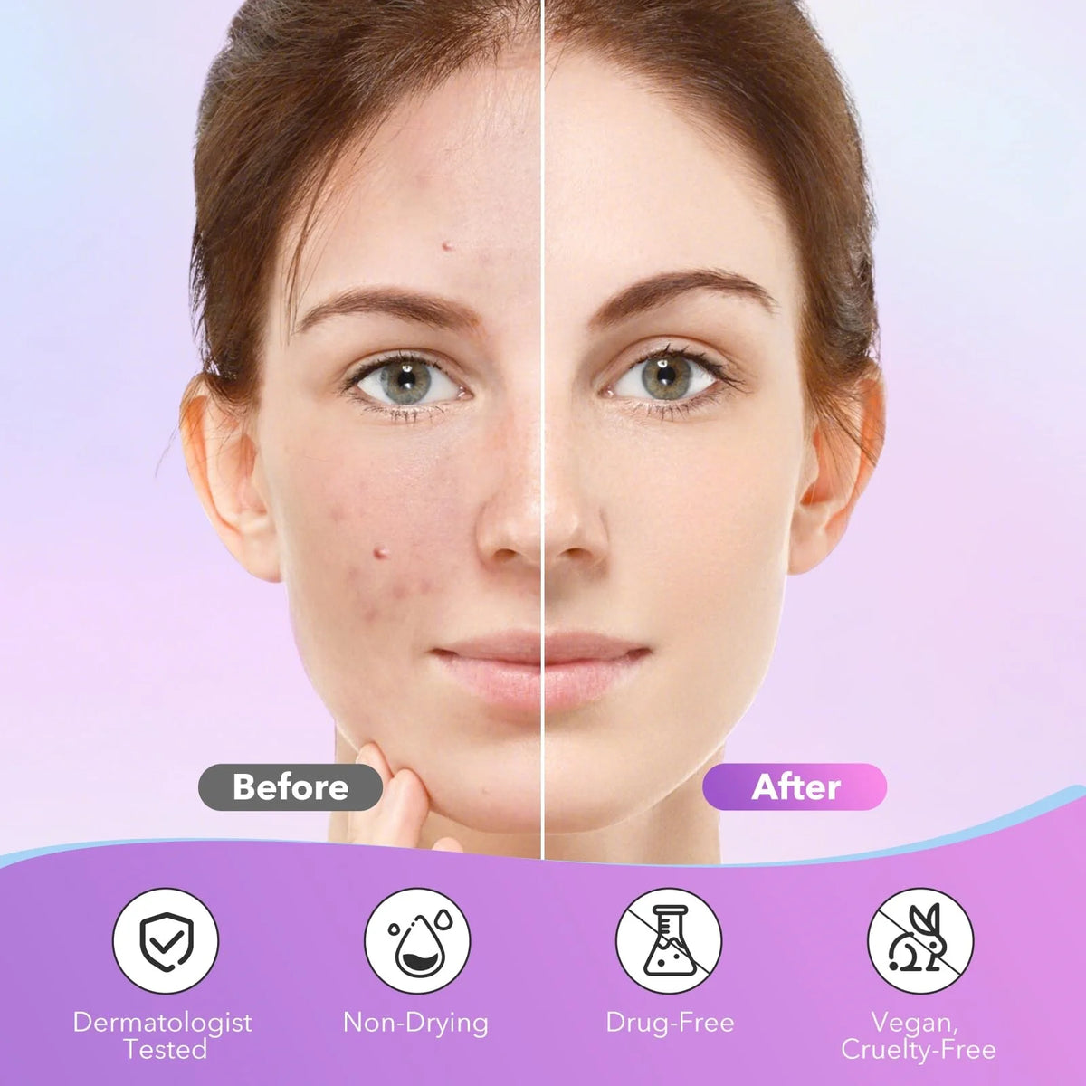 Zora star-shaped skin care patches for blemish coverage, small cosmetic spot care patches on clear skin